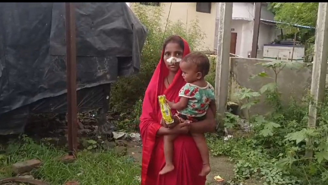 पारिवारिक लड़ाई में पति ने काटी पत्नी की नाक