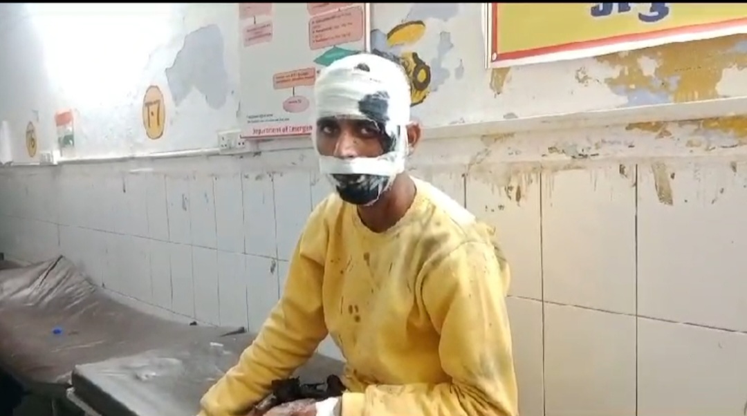 हैलो करते ही मोबाइल में विस्फोट, साले-बहनोई घायल