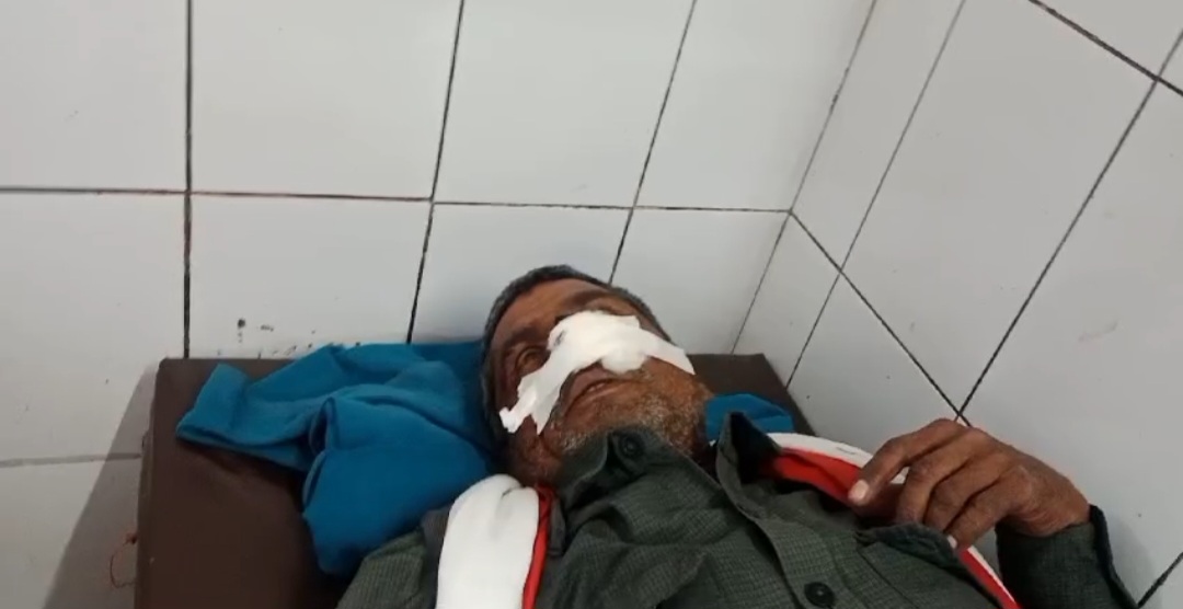 हरदोई में शराब पीने से इनकार करने पर पुलिसकर्मी ने चौकीदार की काटी नाक, गंभीर हालत में रेफर