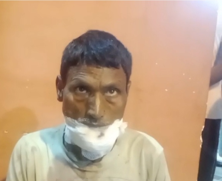 शराब पीने से मना किया तो साले ने जीजा का होंठ दांत से काटा, हालत नाजुक