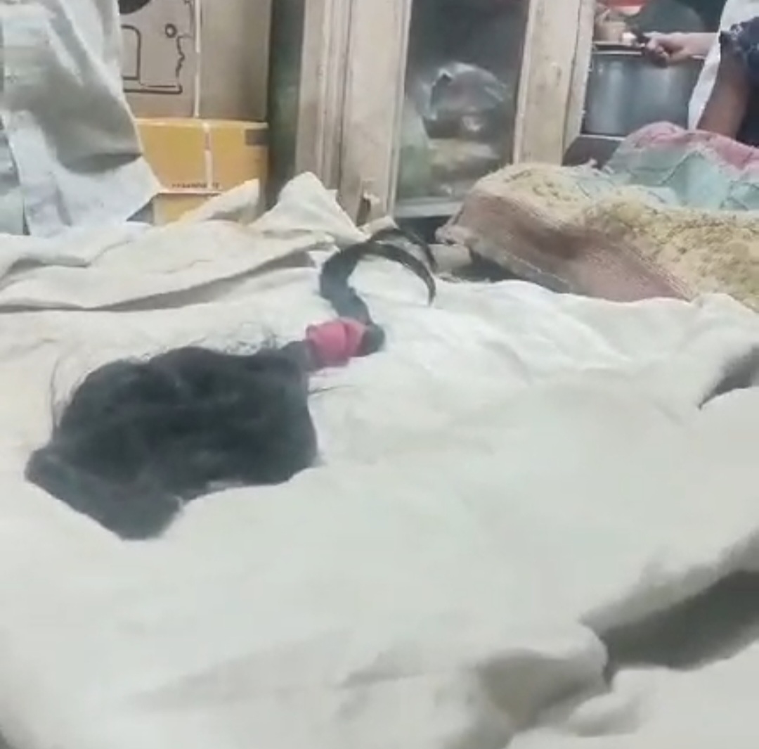 ससुराल आए पति ने पत्नी की चोटी काटी, दहेज उत्पीड़न में मुकदमा दर्ज 