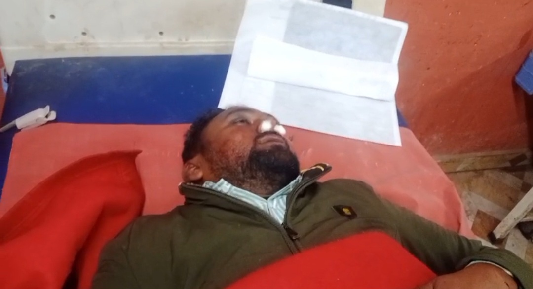 हरदोई में होटल मालिक की दबंगई, तीन अधिवक्ताओं पर जानलेवा हमला, एक की हालत नाजुक, वकीलों में उबाल